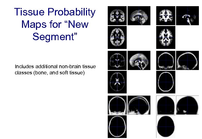 Tissue Probability Maps for “New Segment” Includes additional non-brain tissue classes (bone, and soft