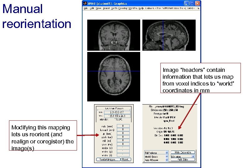 Manual reorientation Image “headers” contain information that lets us map from voxel indices to