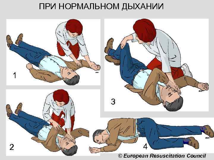 ПРИ НОРМАЛЬНОМ ДЫХАНИИ 1 3 2 4 © European Resuscitation Council 