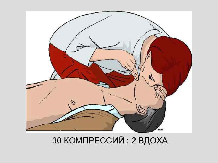 30 КОМПРЕССИЙ : 2 ВДОХА 