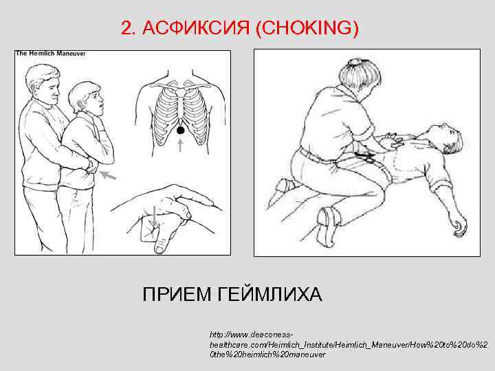 2. АСФИКСИЯ (CHOKING) ПРИЕМ ГЕЙМЛИХА http: //www. deaconesshealthcare. com/Heimlich_Institute/Heimlich_Maneuver/How%20 to%20 do%2 0 the%20 heimlich%20