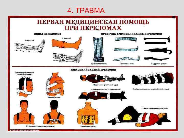 4. ТРАВМА 