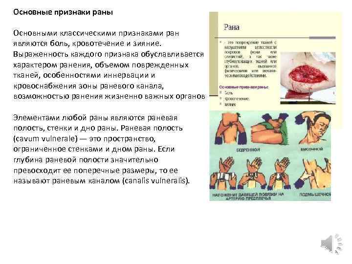 Основные признаки раны Основными классическими признаками ран являются боль, кровотечение и зияние. Выраженность каждого