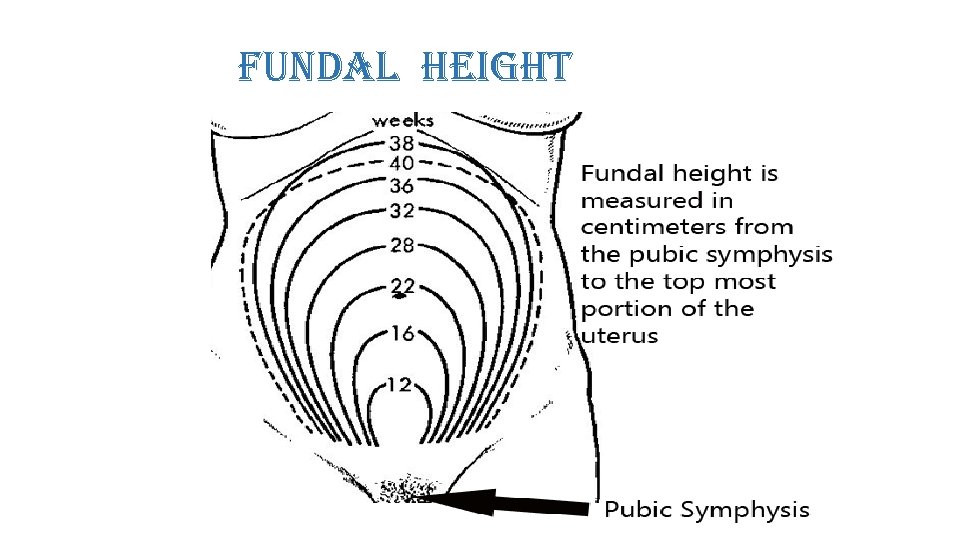 fundal height 