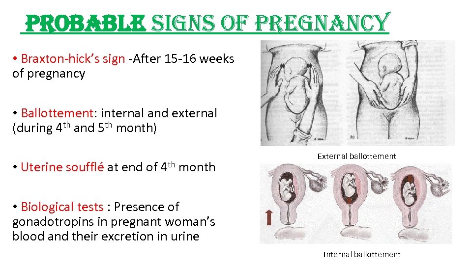 probable signs of pregnancy • Braxton-hick’s sign -After 15 -16 weeks of pregnancy •
