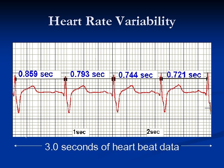 Heart Rate Variability 3. 0 seconds of heart beat data 
