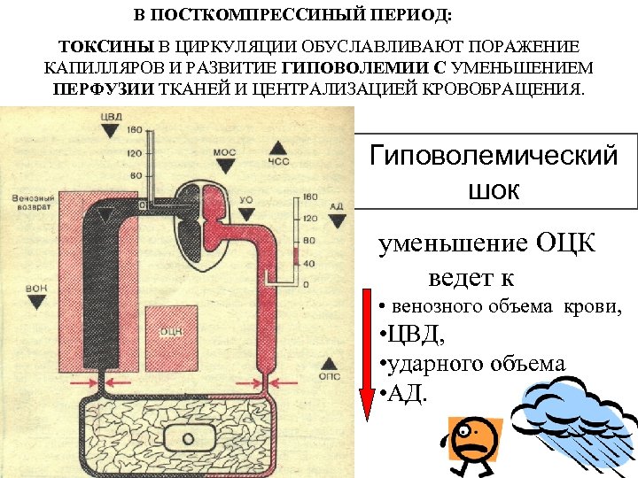 В ПОСТКОМПРЕССИНЫЙ ПЕРИОД: ТОКСИНЫ В ЦИРКУЛЯЦИИ ОБУСЛАВЛИВАЮТ ПОРАЖЕНИЕ КАПИЛЛЯРОВ И РАЗВИТИЕ ГИПОВОЛЕМИИ С УМЕНЬШЕНИЕМ