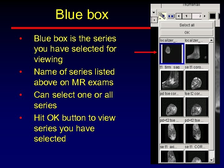 Blue box • • Blue box is the series you have selected for viewing