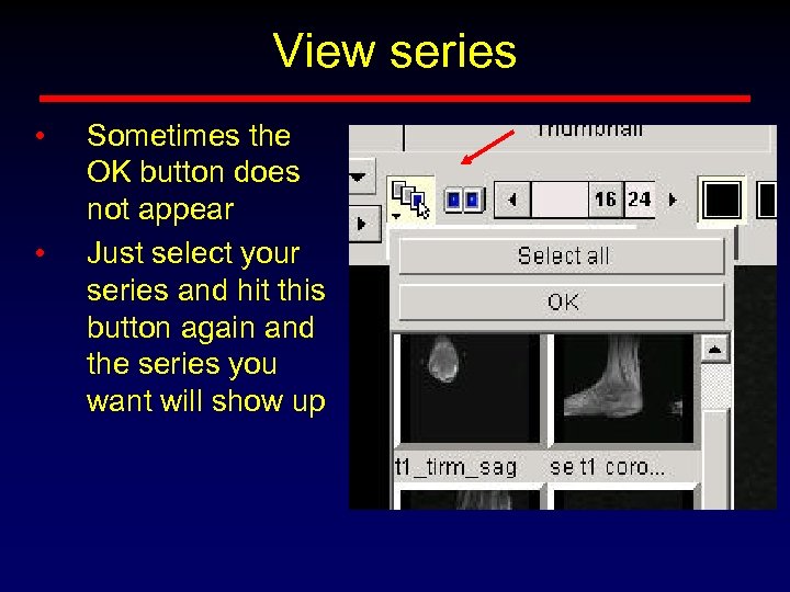 View series • • Sometimes the OK button does not appear Just select your