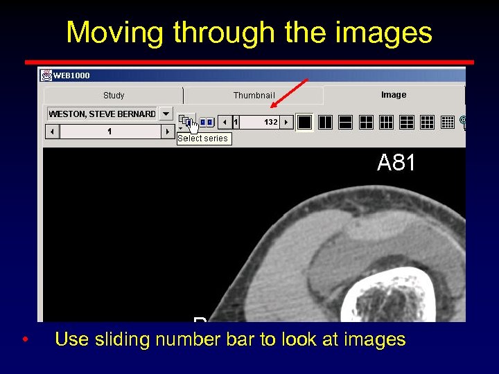 Moving through the images • Use sliding number bar to look at images 