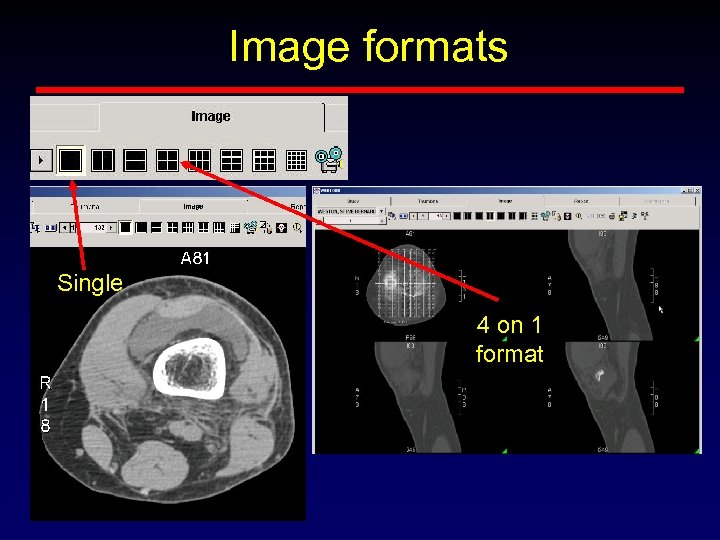 Image formats Single 4 on 1 format 