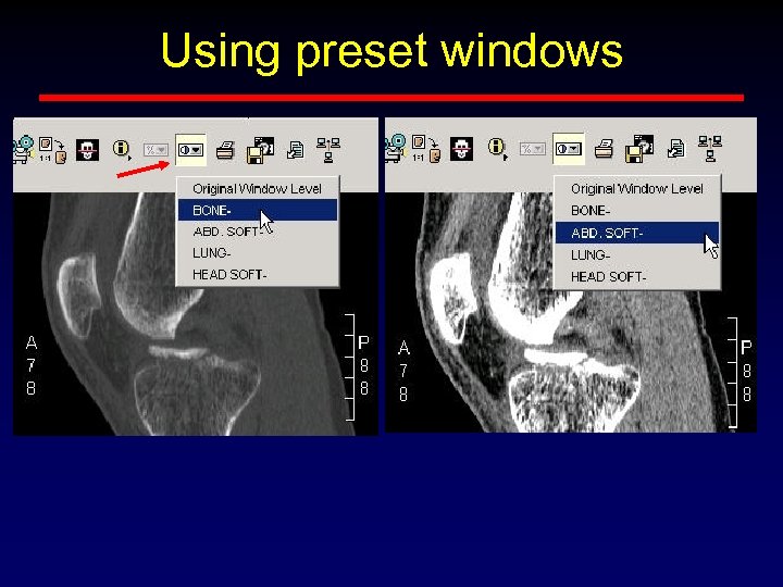 Using preset windows 