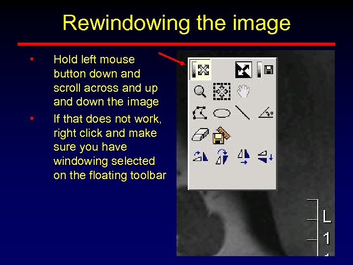 Rewindowing the image • • Hold left mouse button down and scroll across and