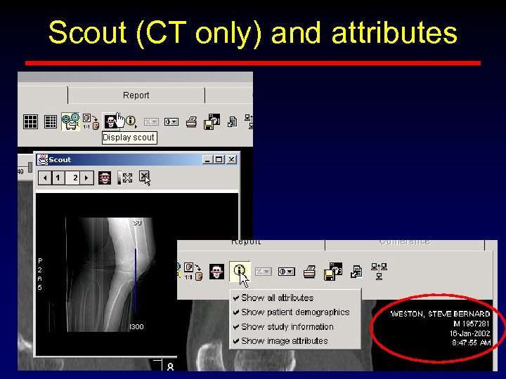 Scout (CT only) and attributes 