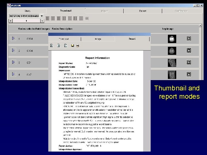 Thumbnail and report modes 