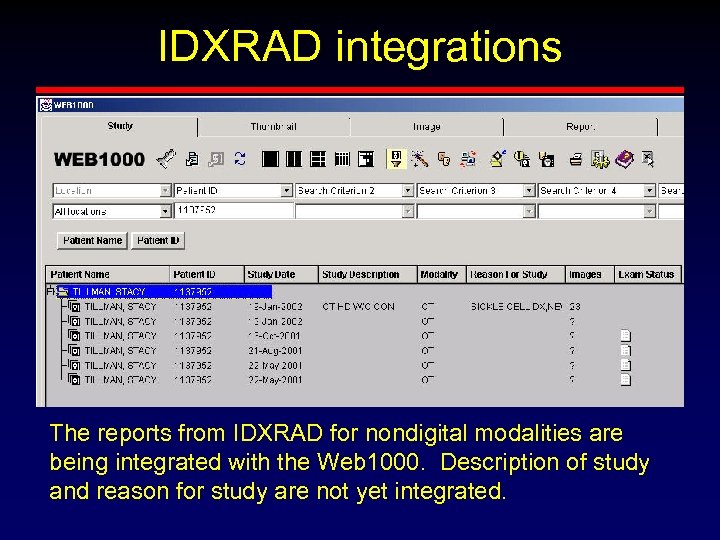 IDXRAD integrations The reports from IDXRAD for nondigital modalities are being integrated with the