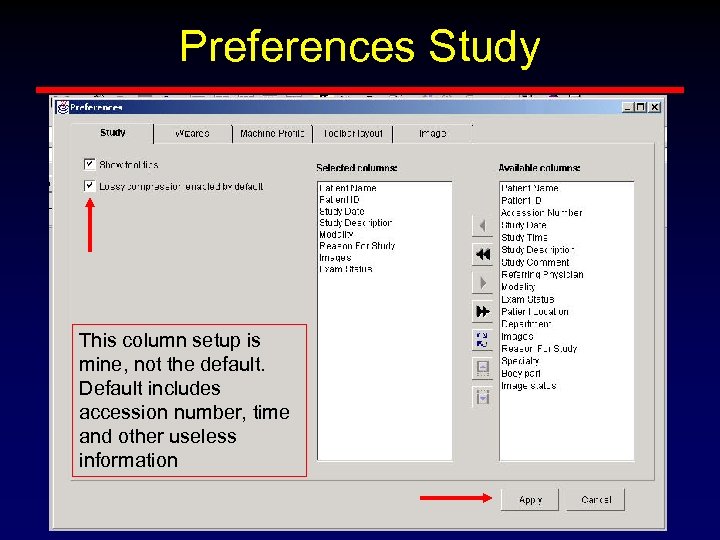 Preferences Study This column setup is mine, not the default. Default includes accession number,