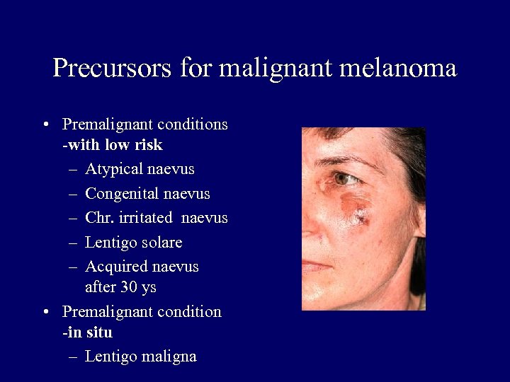 Precursors for malignant melanoma • Premalignant conditions -with low risk – Atypical naevus –