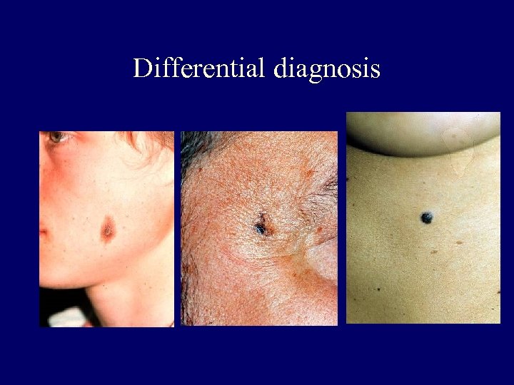 Differential diagnosis 