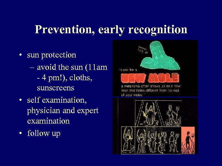 Prevention, early recognition • sun protection – avoid the sun (11 am - 4