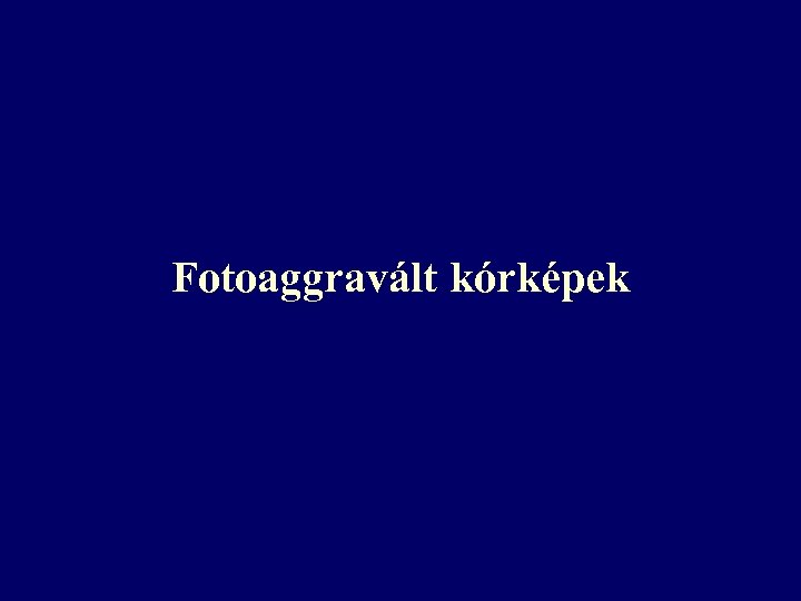 Fotoaggravált kórképek 