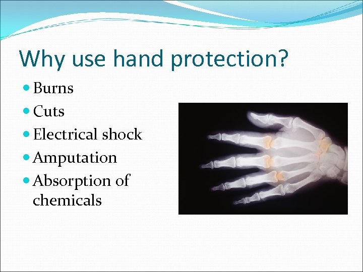 Why use hand protection? Burns Cuts Electrical shock Amputation Absorption of chemicals 