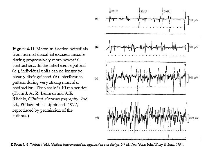 Figure 4. 11 Motor unit action potentials from normal dorsal interosseus muscle during progressively