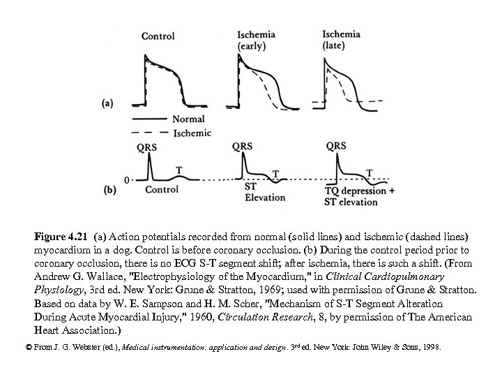 Figure 4. 21 (a) Action potentials recorded from normal (solid lines) and ischemic (dashed