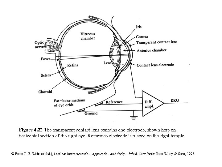 Figure 4. 22 The transparent contact lens contains one electrode, shown here on horizontal