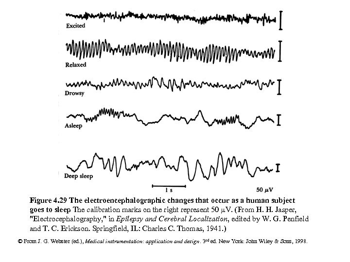 Figure 4. 29 The electroencephalographic changes that occur as a human subject goes to