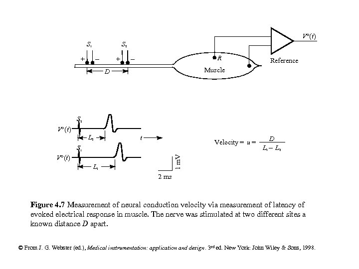 V°(t) S 1 S 2 - + + - R Reference Muscle D S