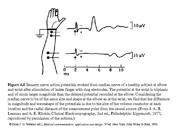 Figure 4. 8 Sensory nerve action potentials evoked from median nerve of a healthy