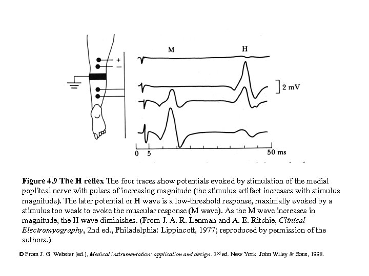 Figure 4. 9 The H reflex The four traces show potentials evoked by stimulation