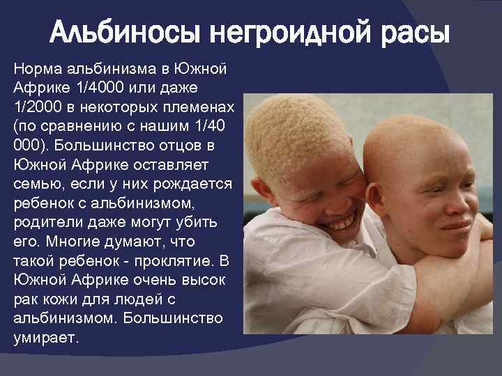 Родился альбиносом. Альбинизм у человека негроидной расы. Появление альбинизма у негроидной расы. Расовые нормы. Расы презентация альбинос.