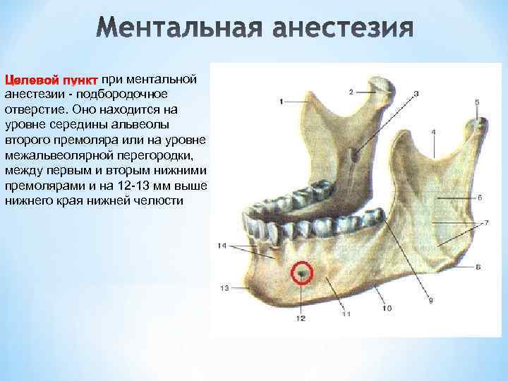 при ментальной анестезии - подбородочное отверстие. Оно находится на уровне середины альвеолы второго премоляра