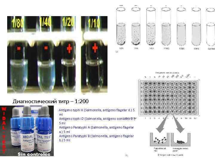 Диагностический титр – 1: 200 Antígeno typhi H (Salmonella, antígeno flagelar d. ) 5