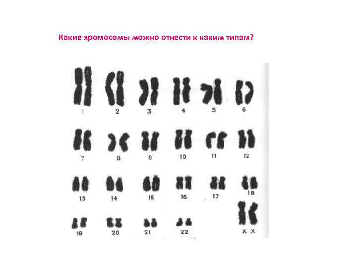 Количество хромосом в кариотипе человека. Кариотип домашней собаки. Цвет кожи в какой хромосоме. Характеристика кариотипов собаки. Схема состава хромосом в кариотипе кошки.