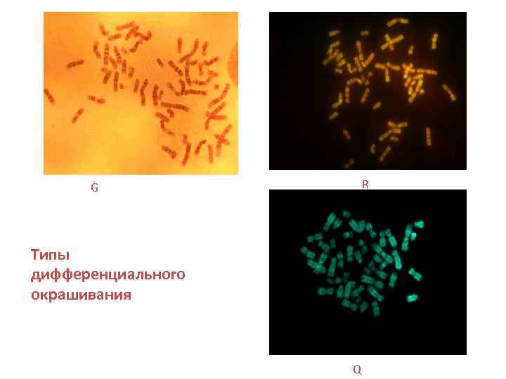 R G Типы дифференциального окрашивания Q 