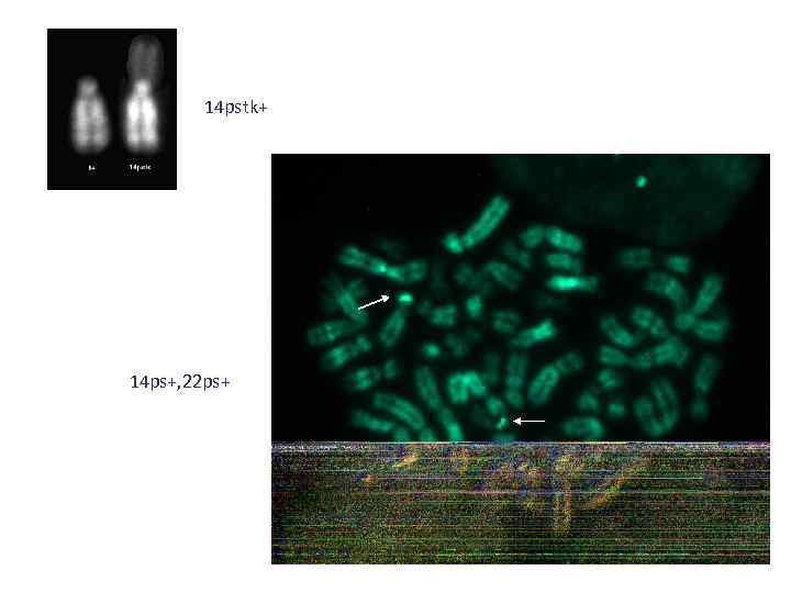 14 pstk+ 14 ps+, 22 ps+ 
