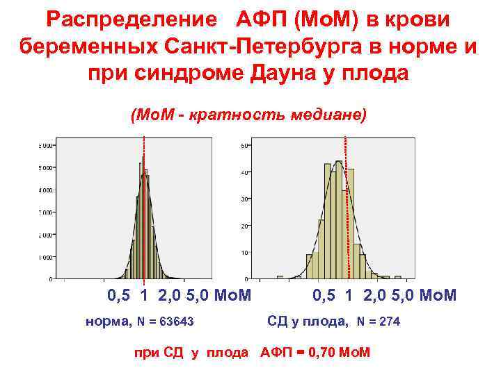 Распределение АФП (Мо. М) в крови беременных Санкт-Петербурга в норме и при синдроме Дауна