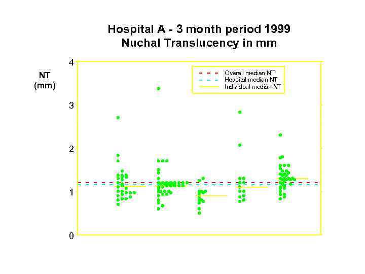 Hospital A - 3 month period 1999 Nuchal Translucency in mm 4 Overall median