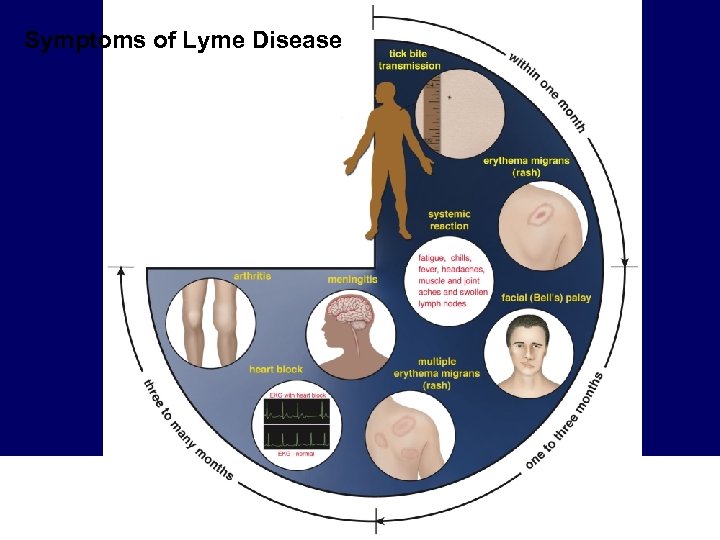 Symptoms of Lyme Disease 