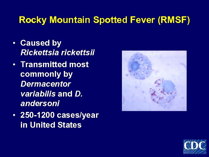 Rocky Mountain Spotted Fever (RMSF) • Caused by Rickettsia rickettsii • Transmitted most commonly