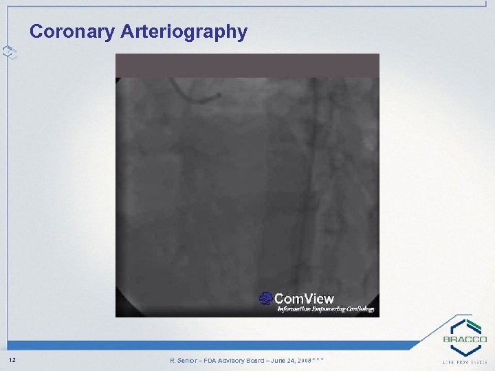 Coronary Arteriography 12 R. Senior – FDA Advisory Board – June 24, 2008 *