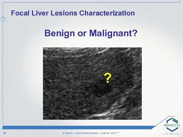 Focal Liver Lesions Characterization Benign or Malignant? ? 22 R. Senior – FDA Advisory