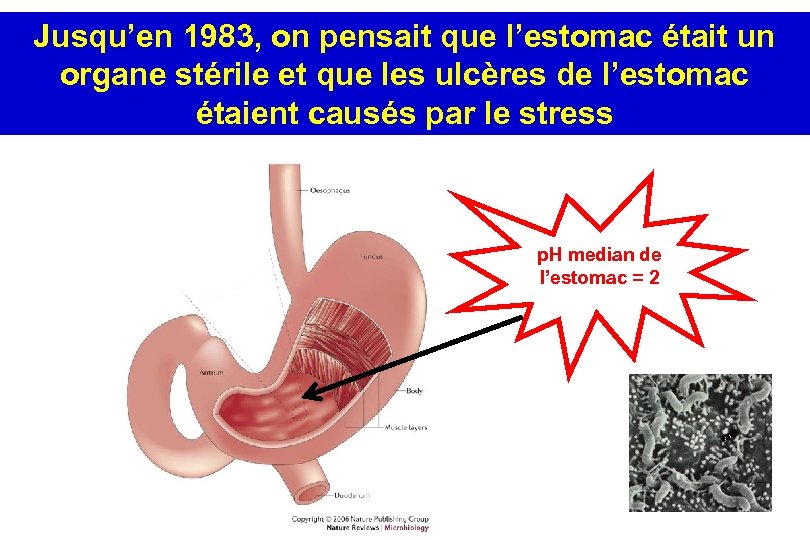 Jusqu’en 1983, on pensait que l’estomac était un organe stérile et que les ulcères
