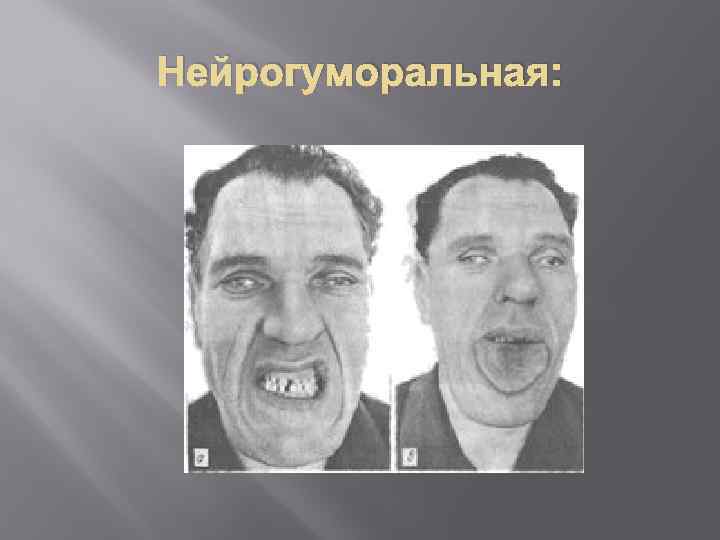 Нейрогуморальная: 