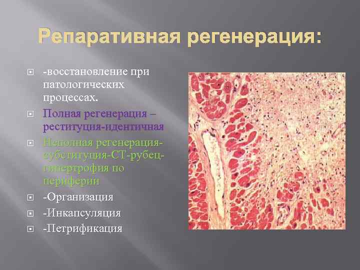 Репаративная регенерация: -восстановление при патологических процессах. Полная регенерация – реституция-идентичная Неполная регенерациясубституция-СТ-рубецгипертрофия по периферии
