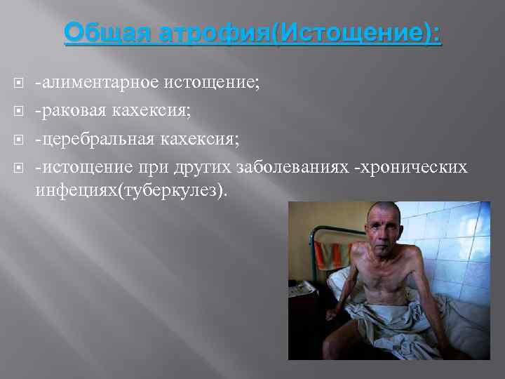Общая атрофия(Истощение): -алиментарное истощение; -раковая кахексия; -церебральная кахексия; -истощение при других заболеваниях -хронических инфециях(туберкулез).