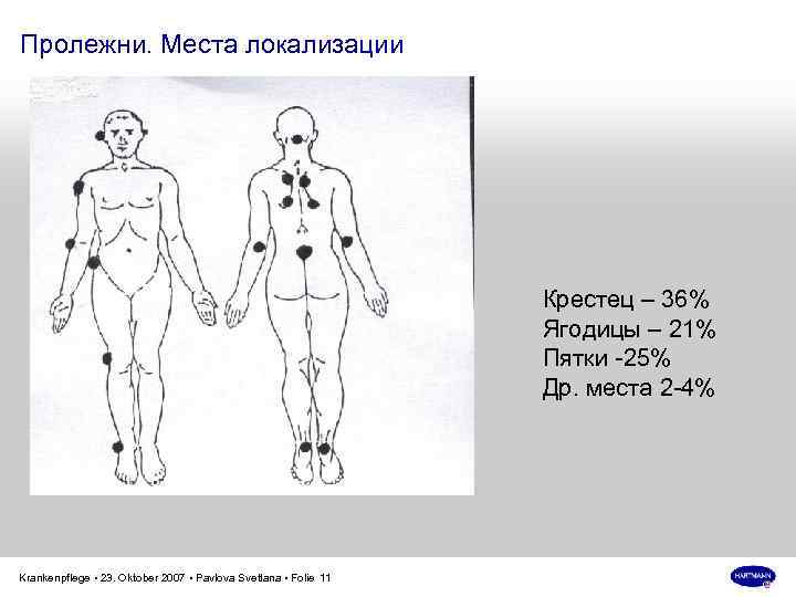 Пролежни. Места локализации Крестец – 36% Ягодицы – 21% Пятки -25% Др. места 2